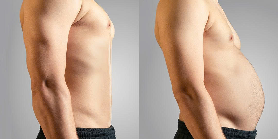 Dấu hiệu cho thấy bạn đang bị mất cơ, nhão cơ