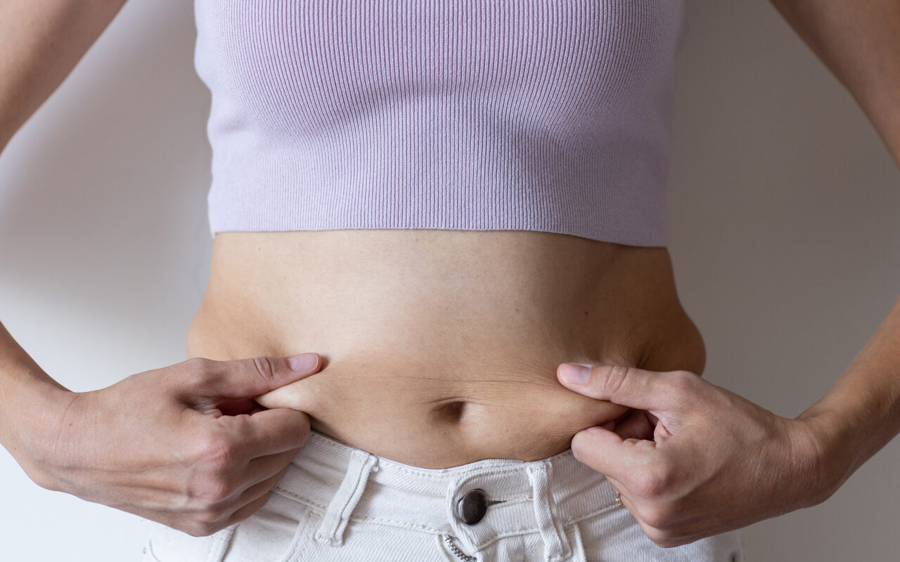  Mất cơ do giảm cân hoặc vận động không cân đối